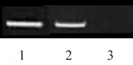 Histone H3K9me2 Antibody in ChIP Assay (ChIP)