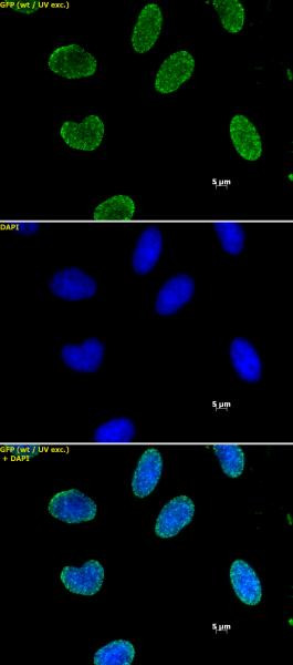 Histone H3K9me2 Antibody in Immunocytochemistry (ICC/IF)