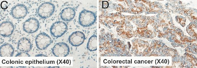 KLF6 Antibody in Immunohistochemistry (IHC)