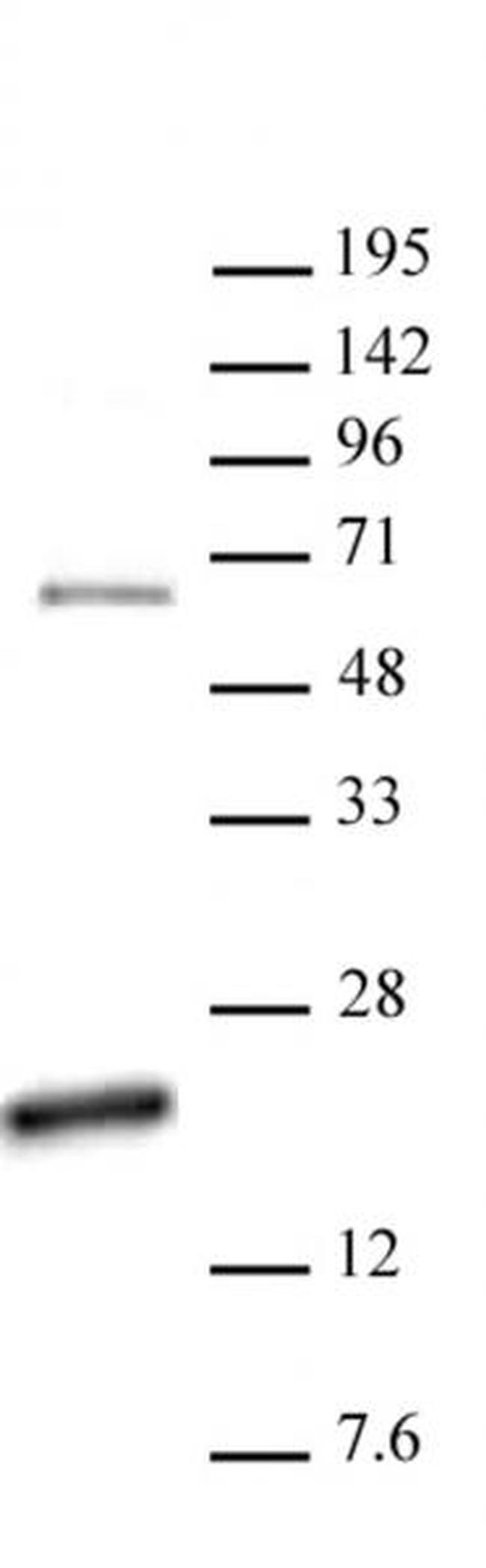 Histone H3R17me2a (asymmetric) Antibody in Western Blot (WB)