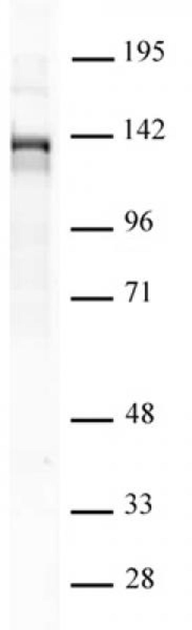 PHF8 Antibody in Western Blot (WB)