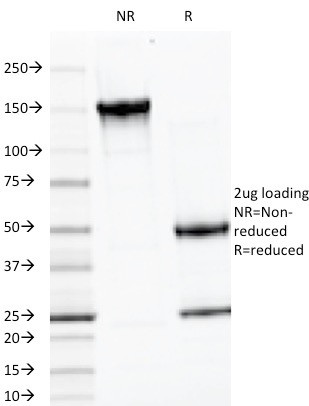 LH-beta (Luteinizing Hormone-beta) Antibody in SDS-PAGE (SDS-PAGE)