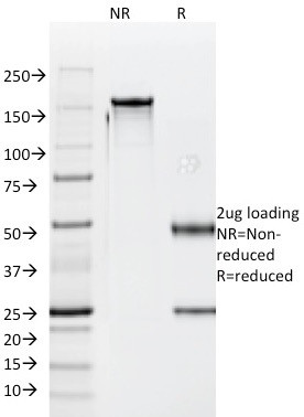 LH-beta (Luteinizing Hormone-beta) Antibody in SDS-PAGE (SDS-PAGE)