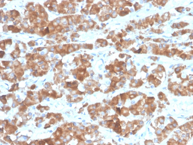 LH-beta (Luteinizing Hormone-beta) Antibody in Immunohistochemistry (Paraffin) (IHC (P))