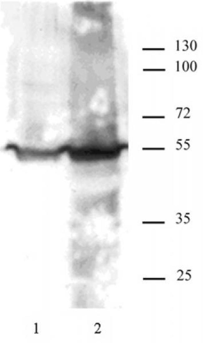 KLF4 Antibody in Western Blot (WB)