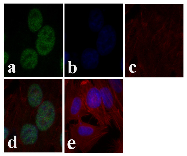 c-Jun Antibody in Immunocytochemistry (ICC/IF)