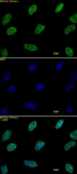 Histone H3K9me2 Antibody in Immunocytochemistry (ICC/IF)