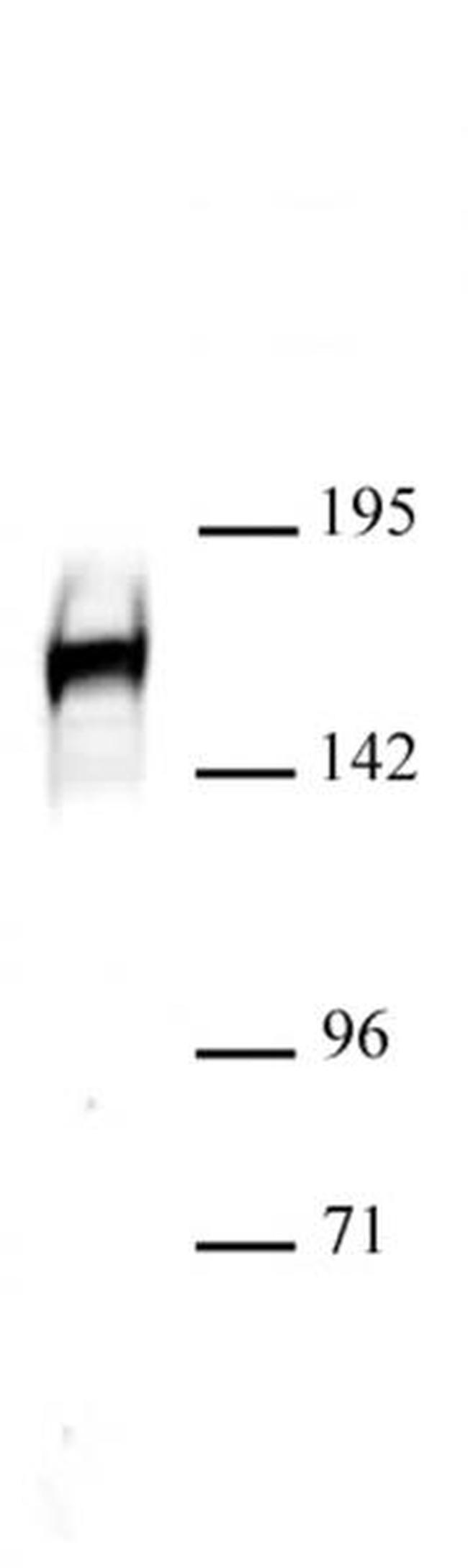 Drosha Antibody in Western Blot (WB)