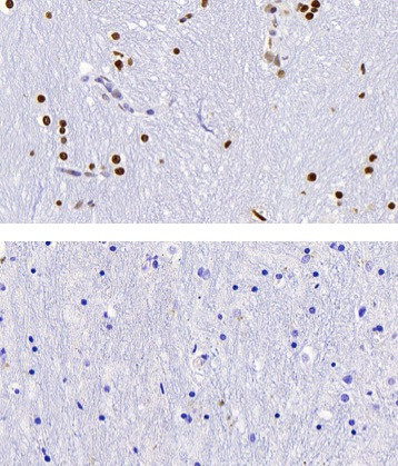 5-Hydroxymethylcytosine (5-hmC) Antibody in Immunohistochemistry (IHC)