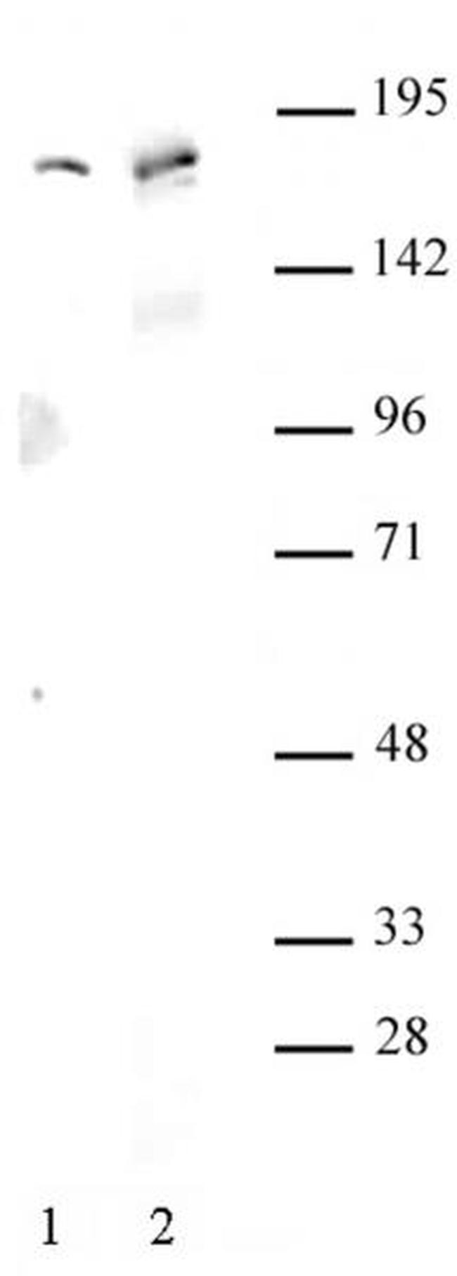 AIB1 / SRC-3 Antibody in Western Blot (WB)