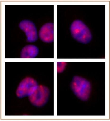 SMARCA2 / BRM Antibody in Immunocytochemistry (ICC/IF)