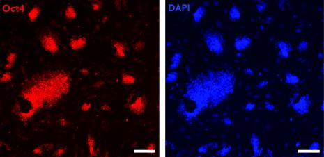 Oct-4 Antibody in Immunocytochemistry (ICC/IF)