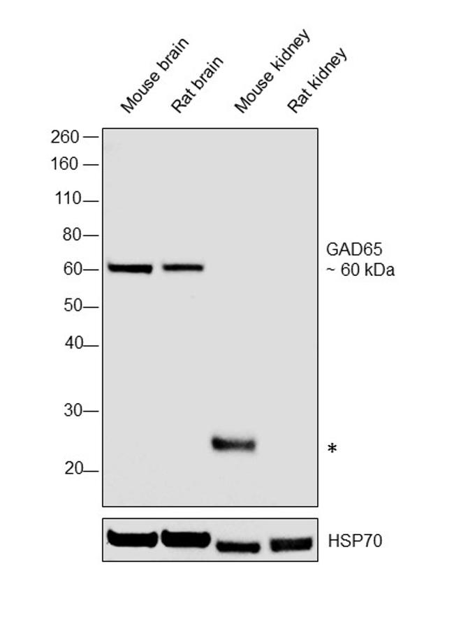 GAD65 Antibody in Western Blot (WB)