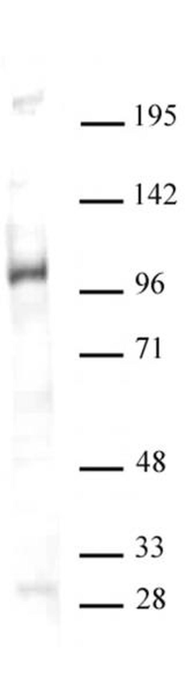 GCN5 Antibody in Western Blot (WB)