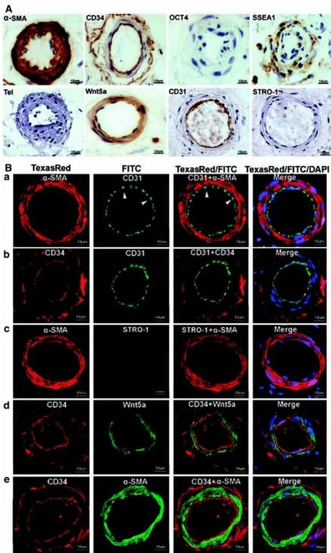 STRO-1 Antibody in Immunohistochemistry (IHC)