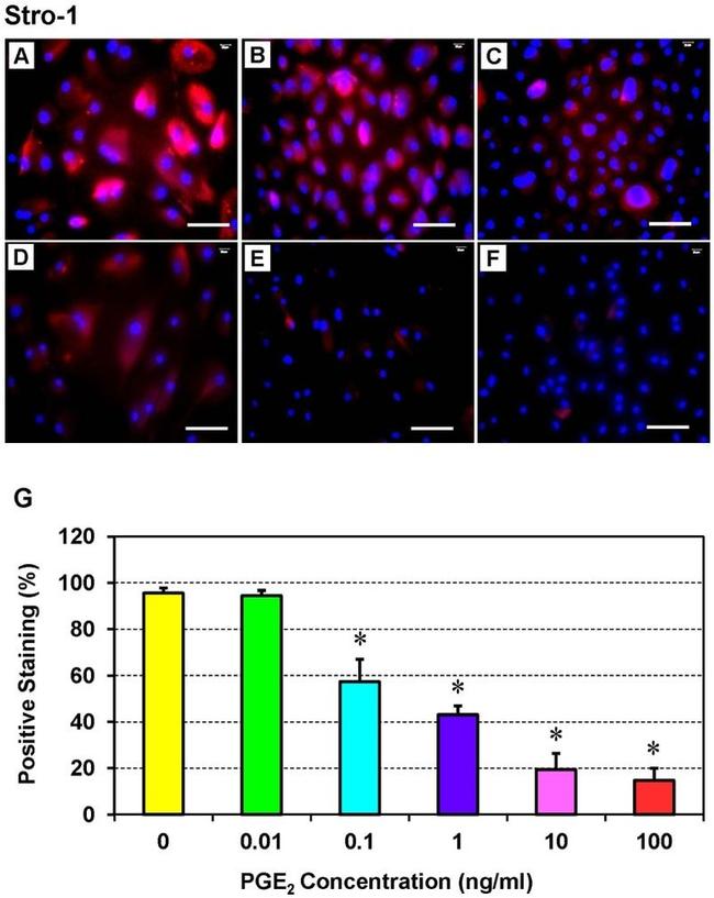 STRO-1 Antibody in Immunocytochemistry (ICC/IF)