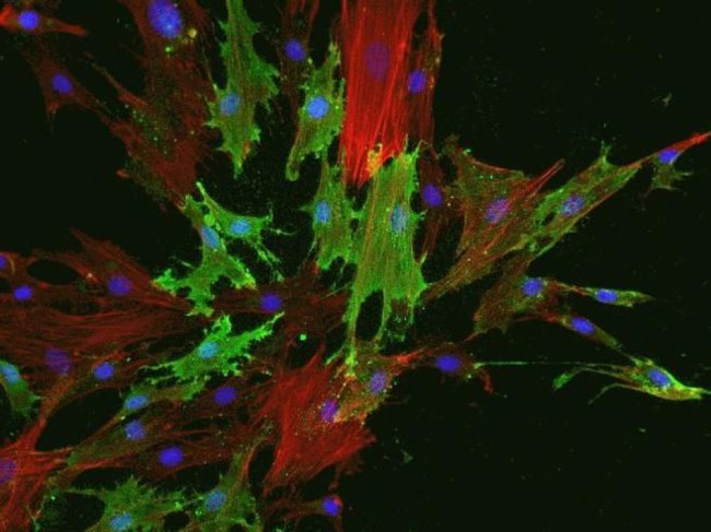 STRO-1 Antibody in Immunocytochemistry (ICC/IF)