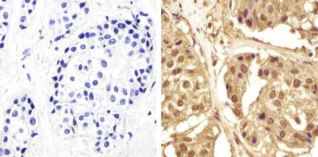 GAPDH Antibody in Immunohistochemistry (Paraffin) (IHC (P))