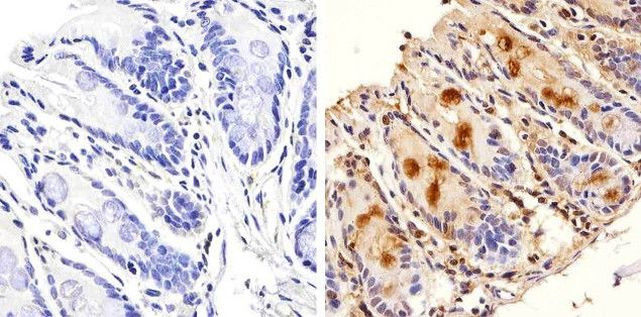 GAPDH Antibody in Immunohistochemistry (Paraffin) (IHC (P))