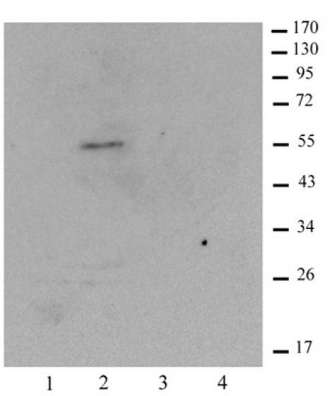 Histone macroH2A1.1 Antibody in Western Blot (WB)