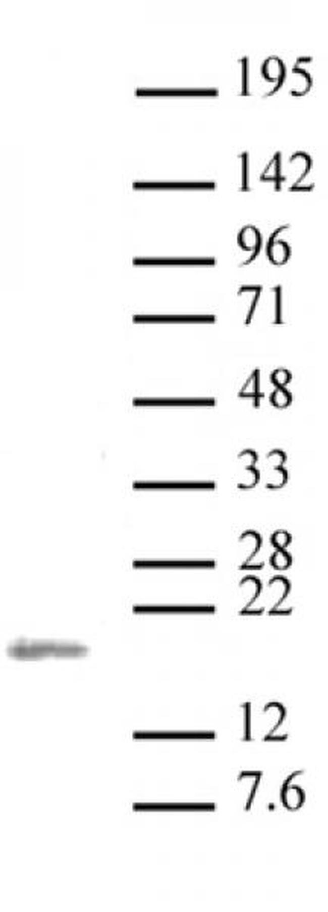 Histone H3K36me2 Antibody in Western Blot (WB)