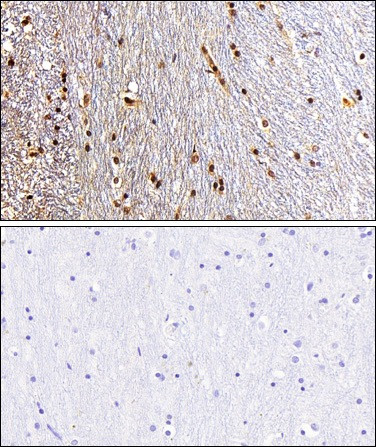 EZH2 Antibody in Immunohistochemistry (Paraffin) (IHC (P))