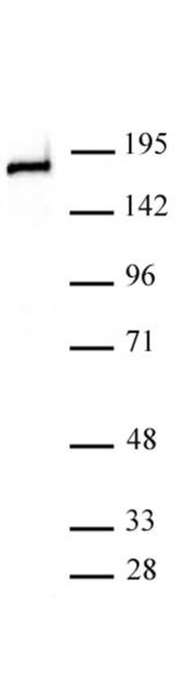 DNMT1 Antibody in Western Blot (WB)