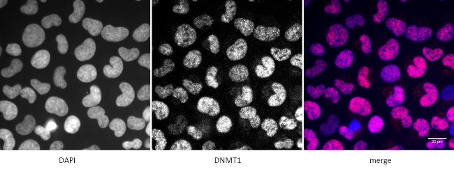 DNMT1 Antibody in Immunocytochemistry (ICC/IF)