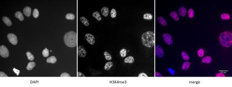 Histone H3K4me3 Antibody in Immunocytochemistry (ICC/IF)
