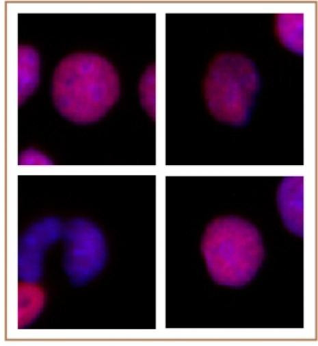 Histone H2A.Z Antibody in Immunocytochemistry (ICC/IF)