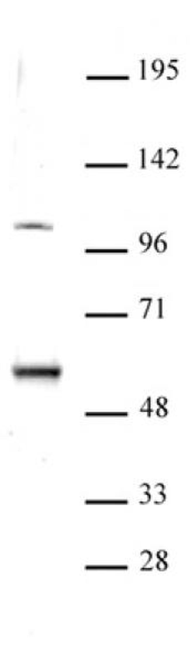 ELP3 Antibody in Western Blot (WB)