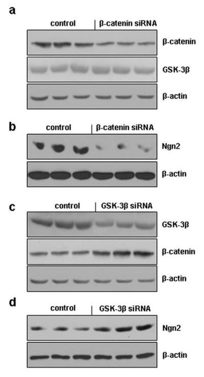 GSK3B Antibody in Western Blot (WB)