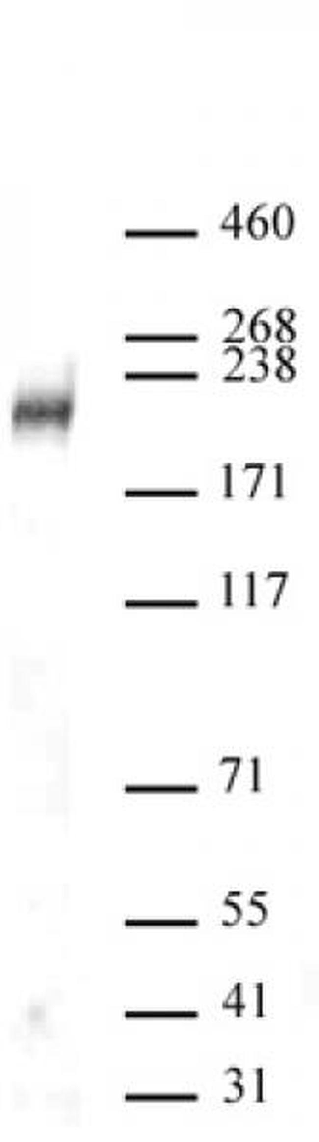 DOT1L Antibody in Western Blot (WB)