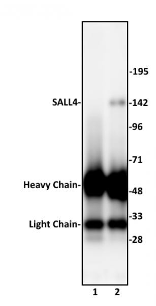 SALL4 Antibody in Immunoprecipitation (IP)