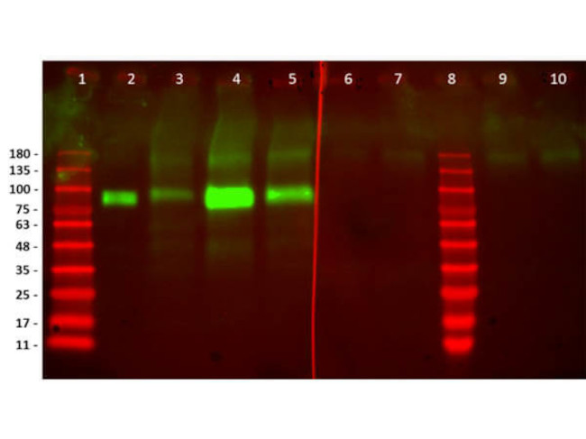 HER2 Fab Antibody in Western Blot (WB)