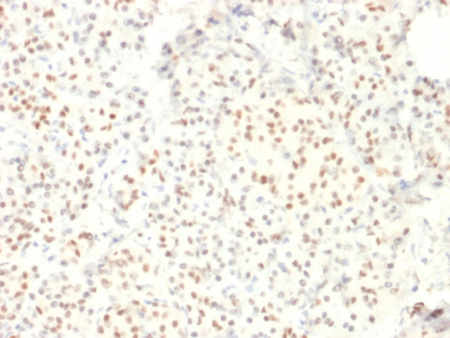 LMO2 (B-Cell Marker) Antibody in Immunohistochemistry (Paraffin) (IHC (P))