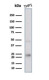 LMO2 Antibody in Western Blot (WB)