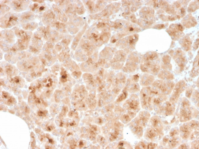 LMO2 Antibody in Immunohistochemistry (Paraffin) (IHC (P))