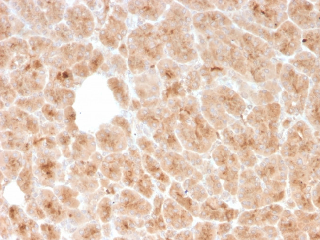 LMO2 Antibody in Immunohistochemistry (Paraffin) (IHC (P))