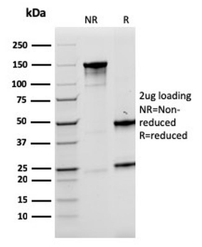 LMO2 Antibody in SDS-PAGE (SDS-PAGE)