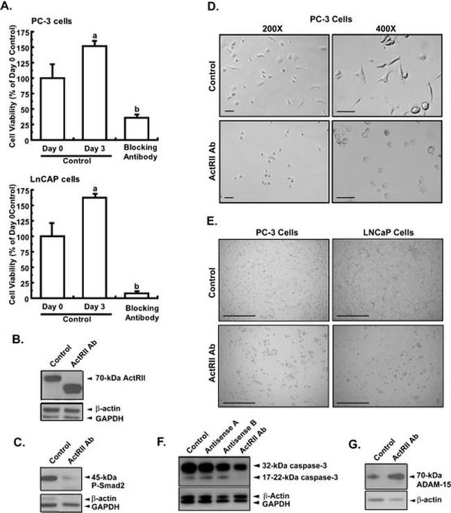 Phospho-SMAD2 (Ser465, Ser467) Antibody in Western Blot (WB)