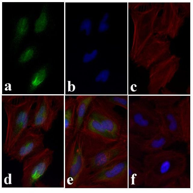 Phospho-SMAD2 (Ser465, Ser467) Antibody in Immunocytochemistry (ICC/IF)