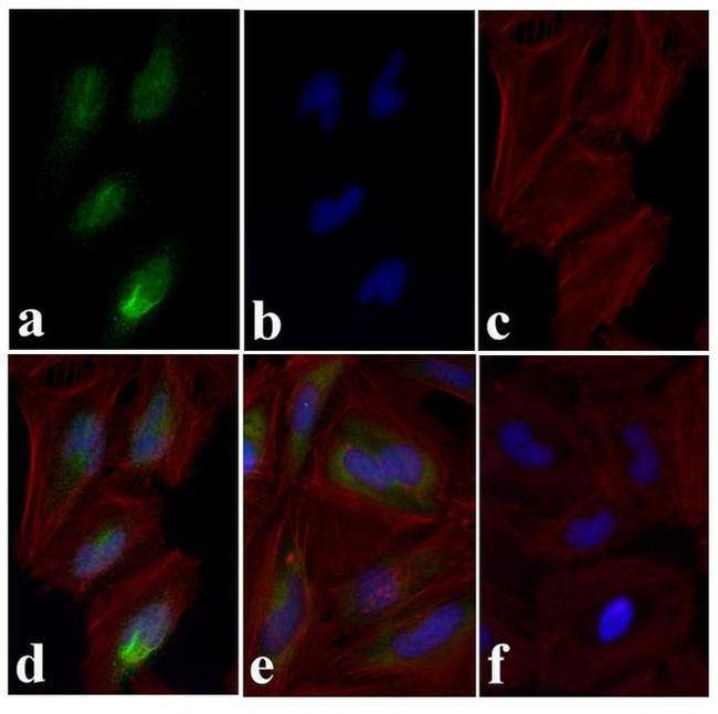 Phospho-SMAD2 (Ser465, Ser467) Antibody