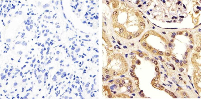 FBXW7 Antibody in Immunohistochemistry (Paraffin) (IHC (P))