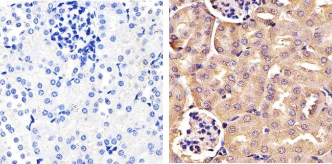 FBXW7 Antibody in Immunohistochemistry (Paraffin) (IHC (P))