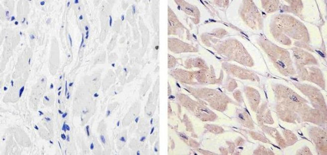 PDGF-D Antibody in Immunohistochemistry (Paraffin) (IHC (P))