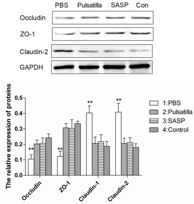 Claudin 2 Antibody