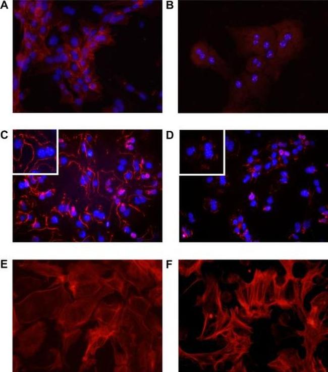 ZO-1 Antibody in Immunocytochemistry (ICC/IF)