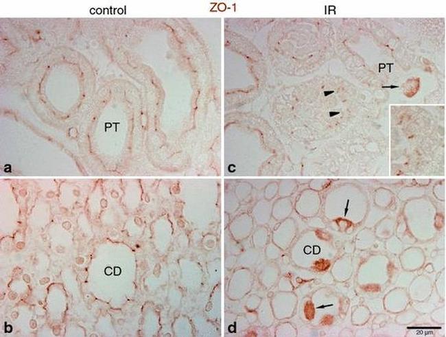 ZO-1 Antibody in Immunohistochemistry (IHC)