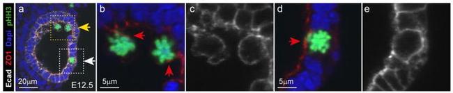 ZO-1 Antibody in Immunohistochemistry (IHC)